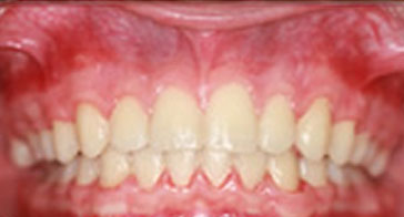 After Orthodontist Treatment Image 6